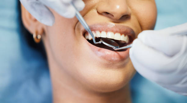 Best After-Hours Emergency Dentist in Dunmore, PA
