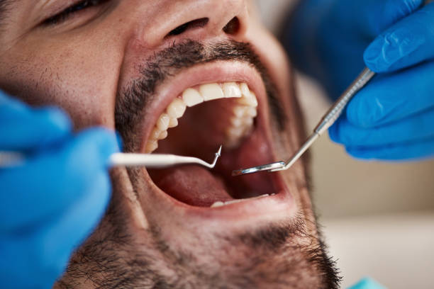 Best Emergency Treatment for Toothache in Dunmore, PA