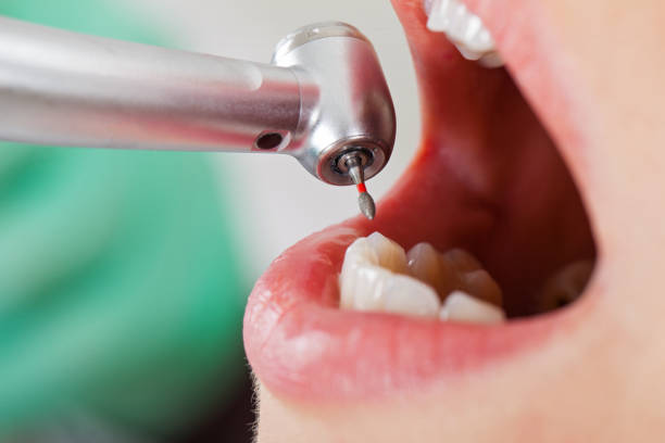 Best Emergency Treatment for Toothache in Dunmore, PA